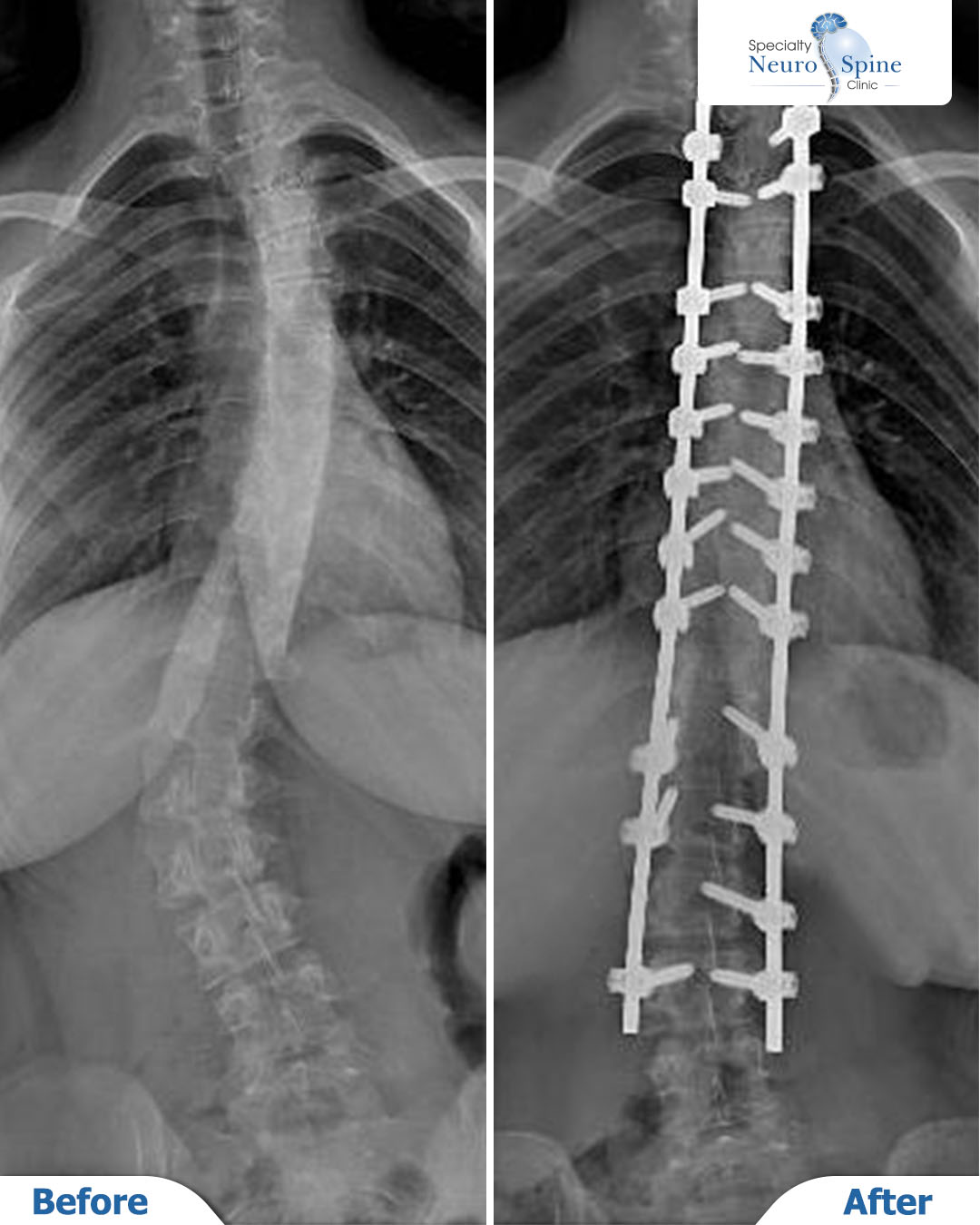 Before and After Teba - 01