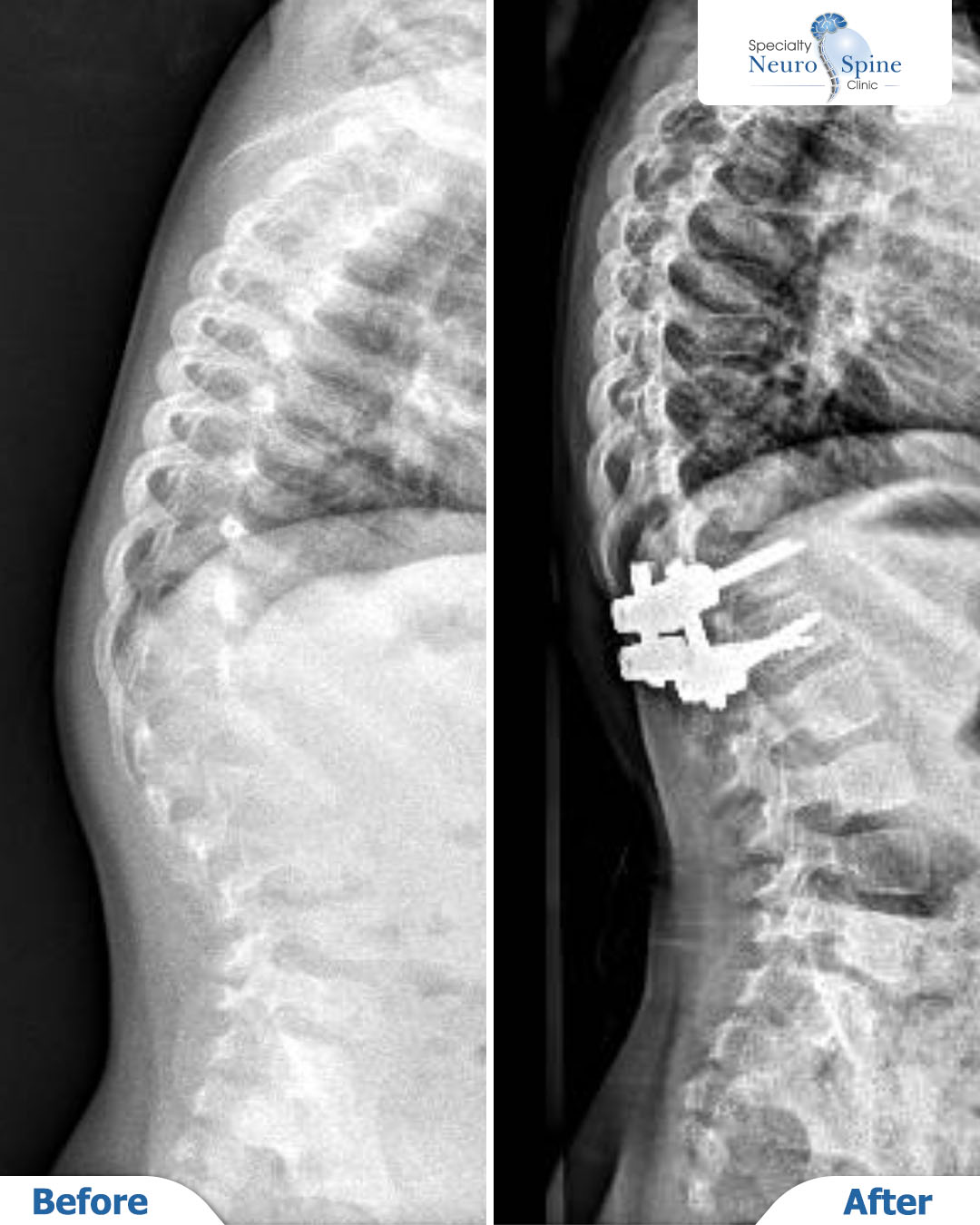 Before and After سالي - 01