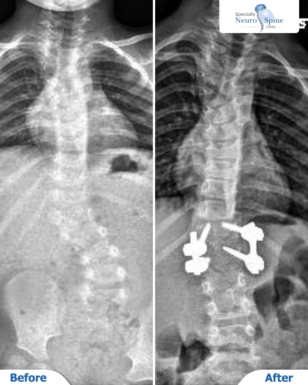 Before and After سالي02