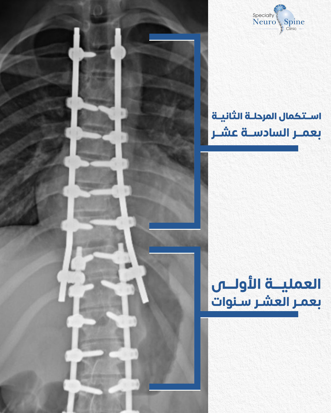 Before and After فلسطين احمد - 010000