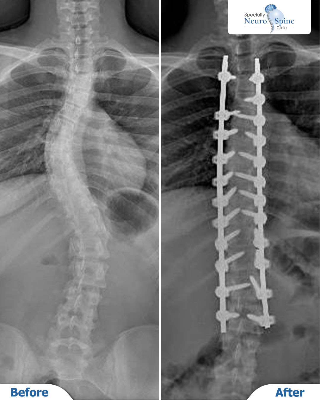 Before and After مريم - 01