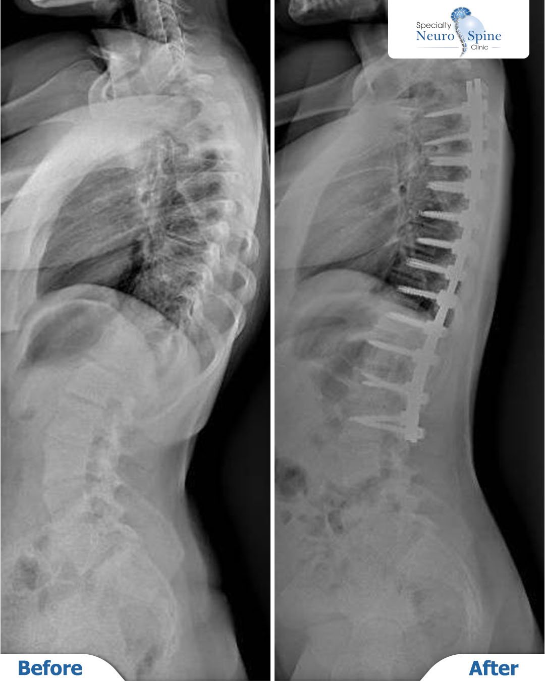 Before and After مريم - 02
