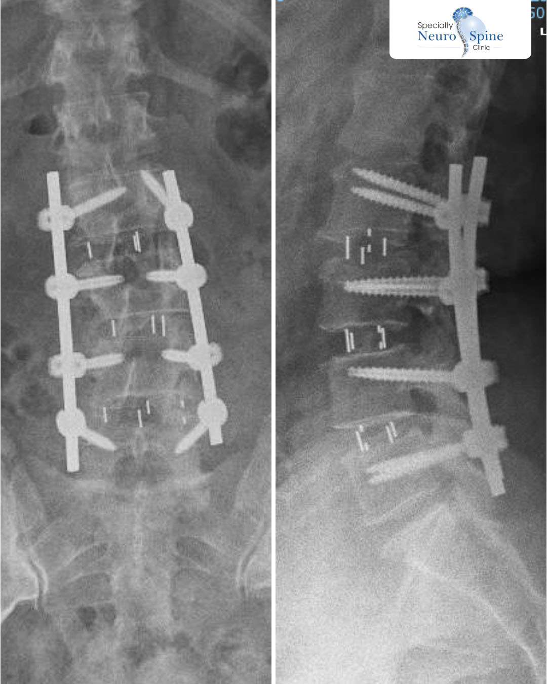 Before and After منتهى - 02