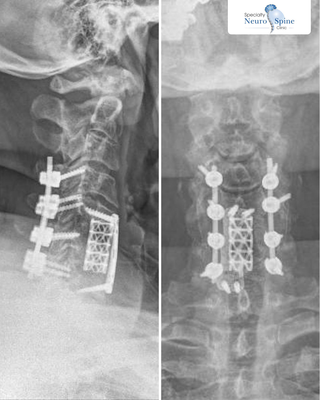 Before and After Amer - 01