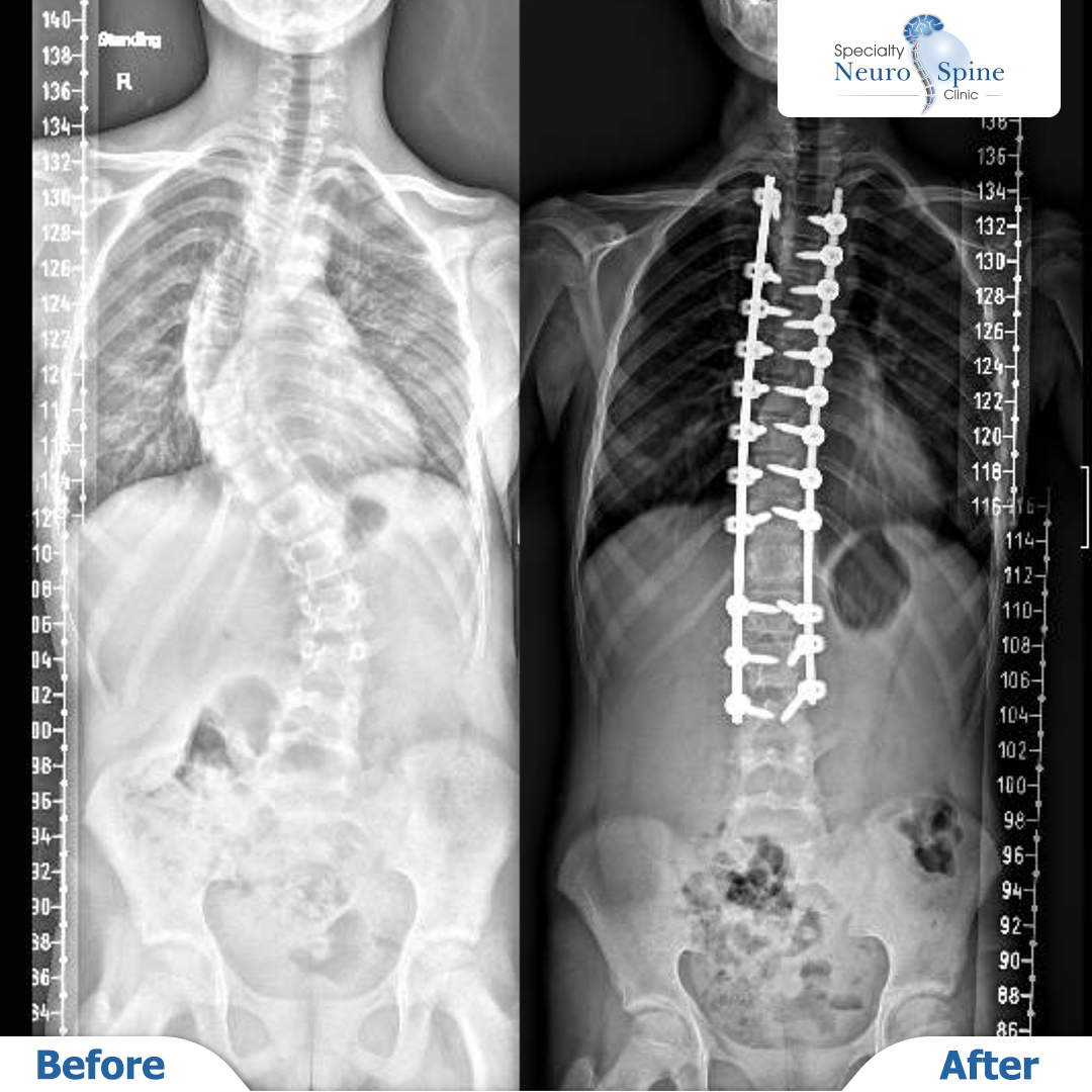 Before and After 2-02