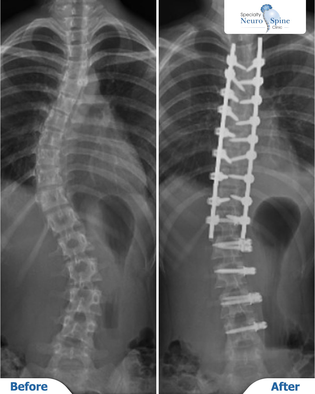 Before and After Francis - 01