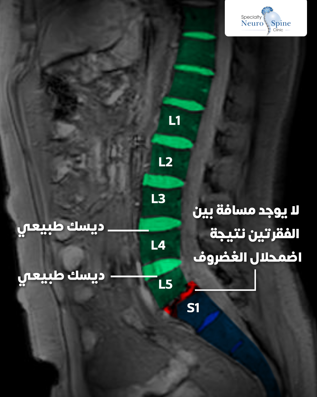 صورة أشعه