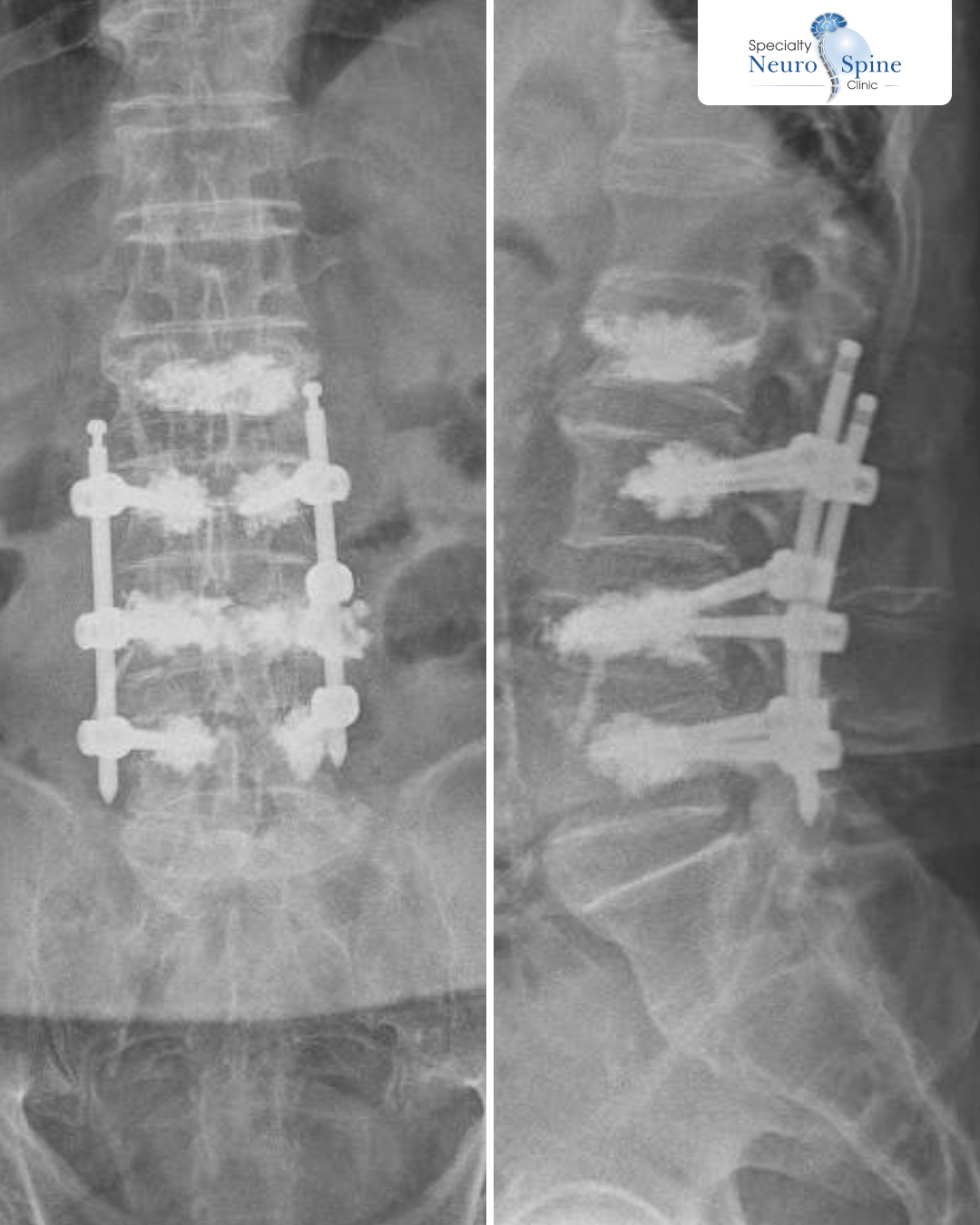 Hafez Xray post