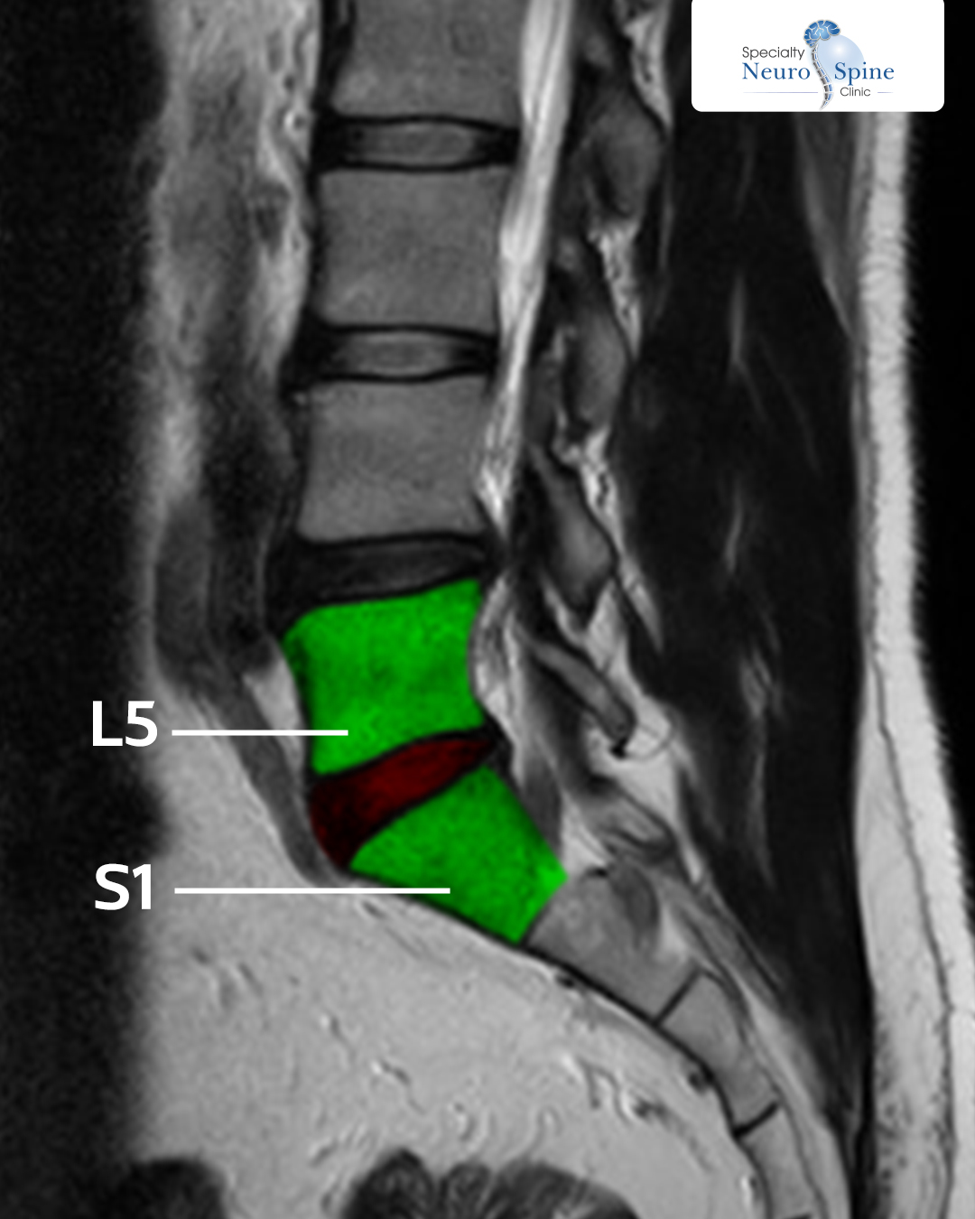 Mariam post xray (1)